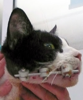 fractura mandibular funcion masticacion oclusion buenas.
