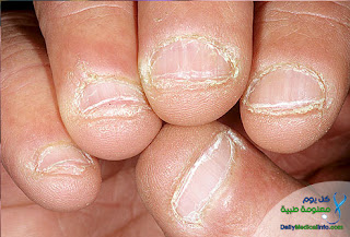 اظافرك عنوان صحتك Nails+%288%29