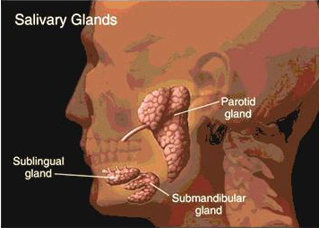 Right Parotitis