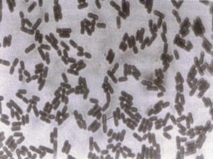 LAS BACTERIAS PRODUCEN ENFERMEDADES las bacterias producen enfermedades: