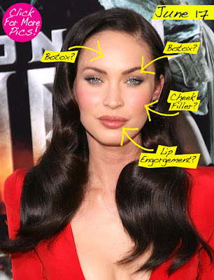 Megan Fox, one of the famous hollywood celebrity, had many plastic and cosmetic surgeries such as botox, check filler surgery, lip engorgement, breast implant and others. This is the reality behind her successful hollywood career. However now she looks 