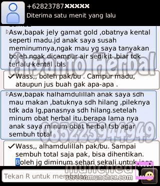 http://obatbatukpilekpadaanak.blogspot.com/