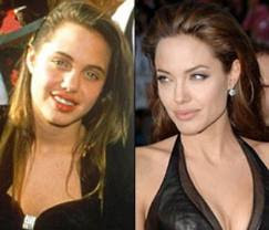 ANGELINA JOLIE BEFORE and AFTER