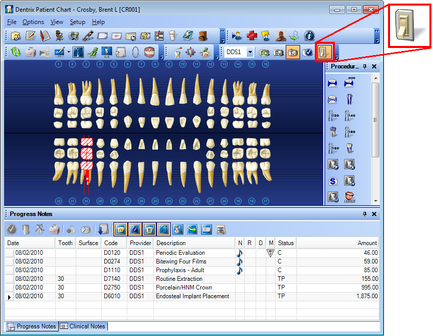 dentrix tip tuesdays the auto state button dentrix dental charting