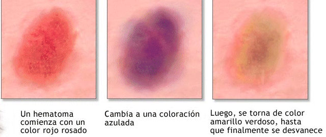 Ekzoderil que hay unos análogos