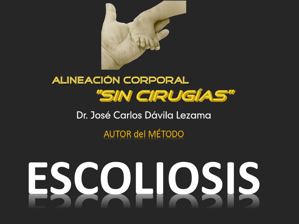 ESCOLIOSIS