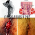 Sakit Wasir dan Obat Ambeven Alami thumbnail