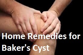 How To Treat Bakers Cyst At Home - Home Remedies For Baker's Cyst