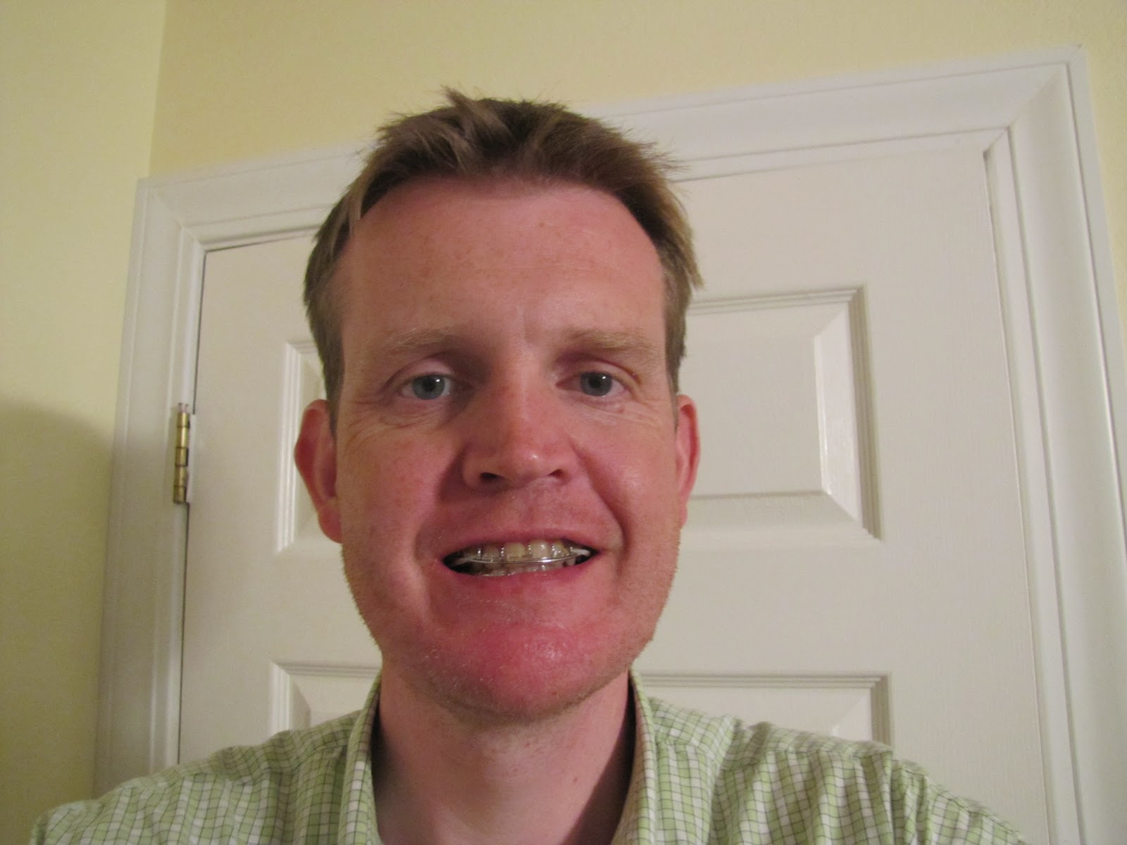 Double Jaw Operation The Road to Recovery