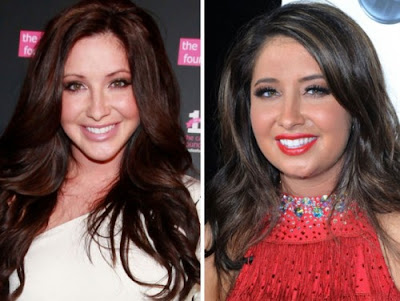 Bristol Palin Plastic Surgery