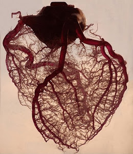 قلب بشري مصور بتقنية اظهار الأوعية الدموية،واستبعاد الدهون والعضلات