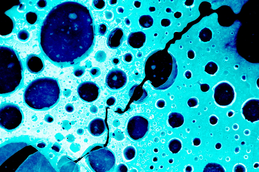 skin cancer in relation to the skin cancer in relation to the