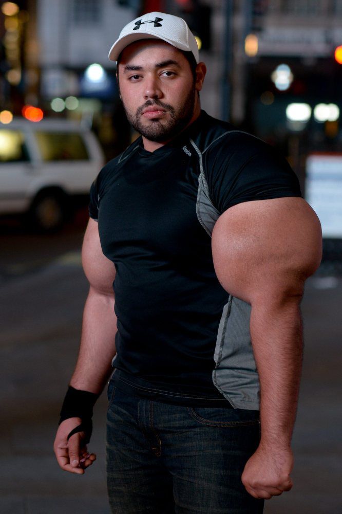 Pix Grove A Man with Biggest Biceps in the World