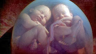 Unborn Twins