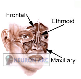 Paranasal Sinuses Frontal, Maxillary, Sphenoid, Ethmoidal Sinuses image51 Paranasal Sinuses Frontal, Maxillary, Sphenoid, Ethmoidal Sinuses