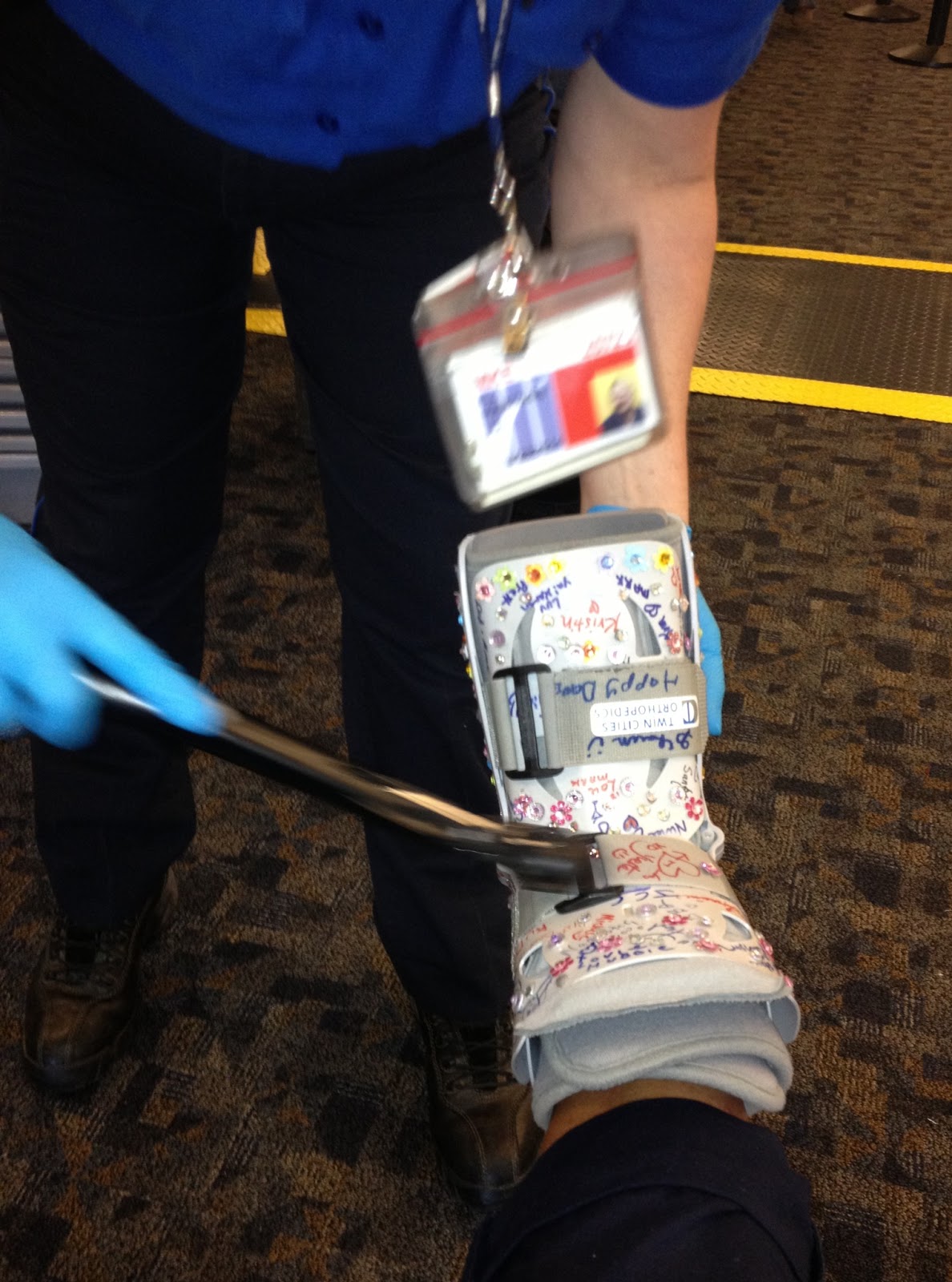 After LisFranc Surgery Getting through TSA airport security after