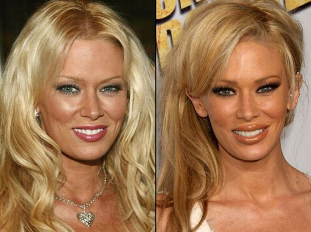 Jenna Jameson Antes y Despues Jenna Jameson Antes y Despues