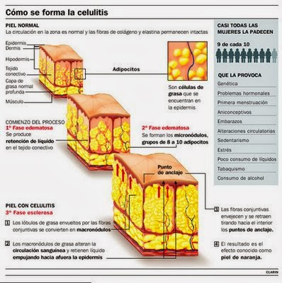 joseherbalife: Diez consejos para Luchar contra la Celulitis joseherbalife: Diez consejos para Luchar contra la Celulitis