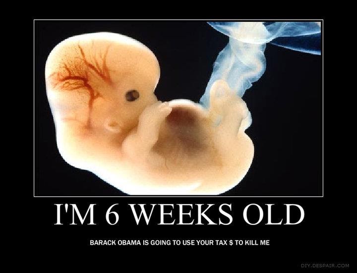 Clinic Quotes: Picture of 6 Week Old Unborn Baby
