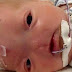 Ce bambin est né avec une rare condition: il n'a pas de nez, mais admirez ce qu'il est devenu!