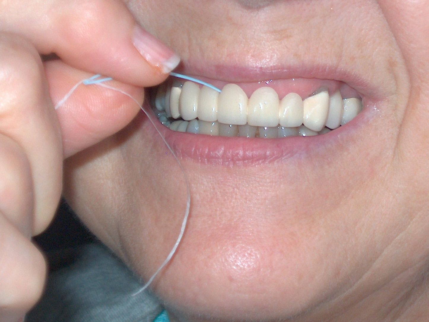 Bridge Garden Picture สิงหาคม 2013