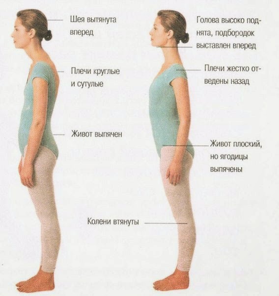 Подбор корсетов при сколиозе