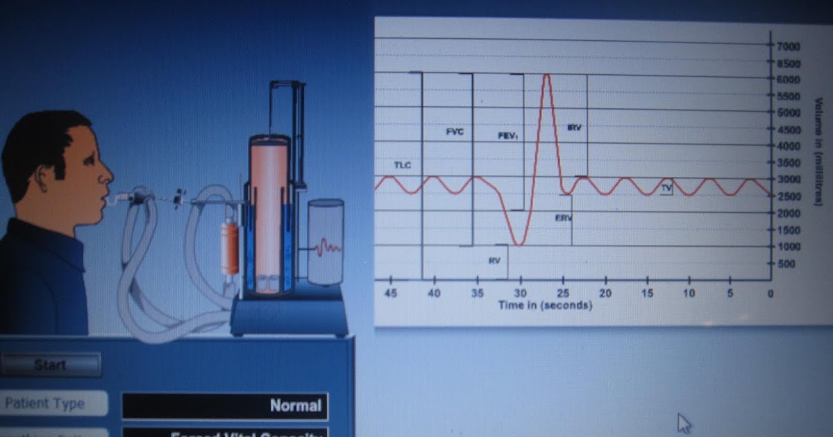 Brenda's A & P Eportfolio Objective 50 Demonstrate spirometer use and