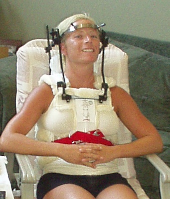 Neck Halo