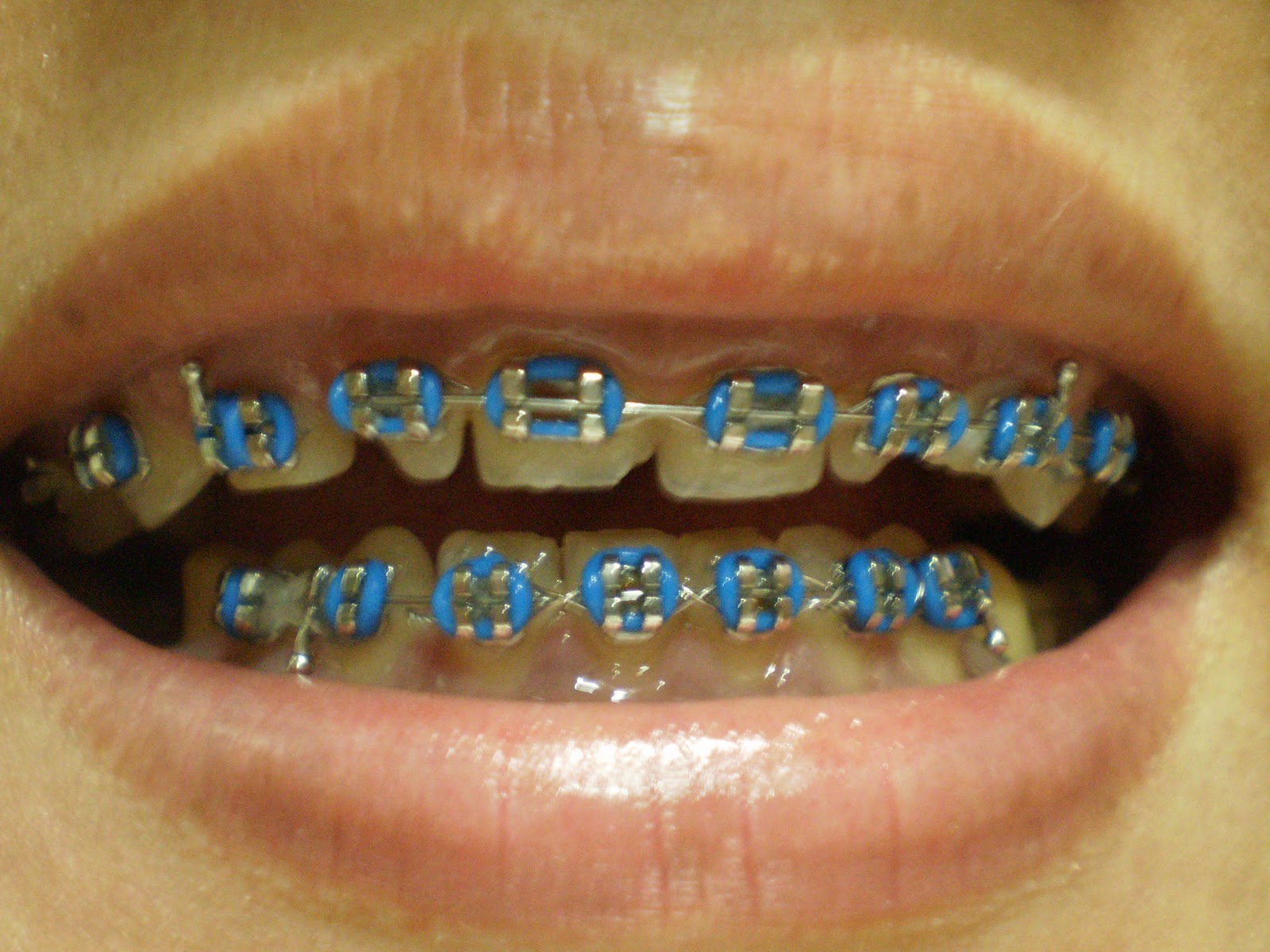 yaris8096: \u0e15\u0e31\u0e27\u0e2d\u0e22\u0e48\u0e32\u0e07\u0e2a\u0e35\u0e22\u0e32\u0e07\u0e08\u0e31\u0e14\u0e1f\u0e31\u0e19...3