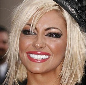 extra white teeth