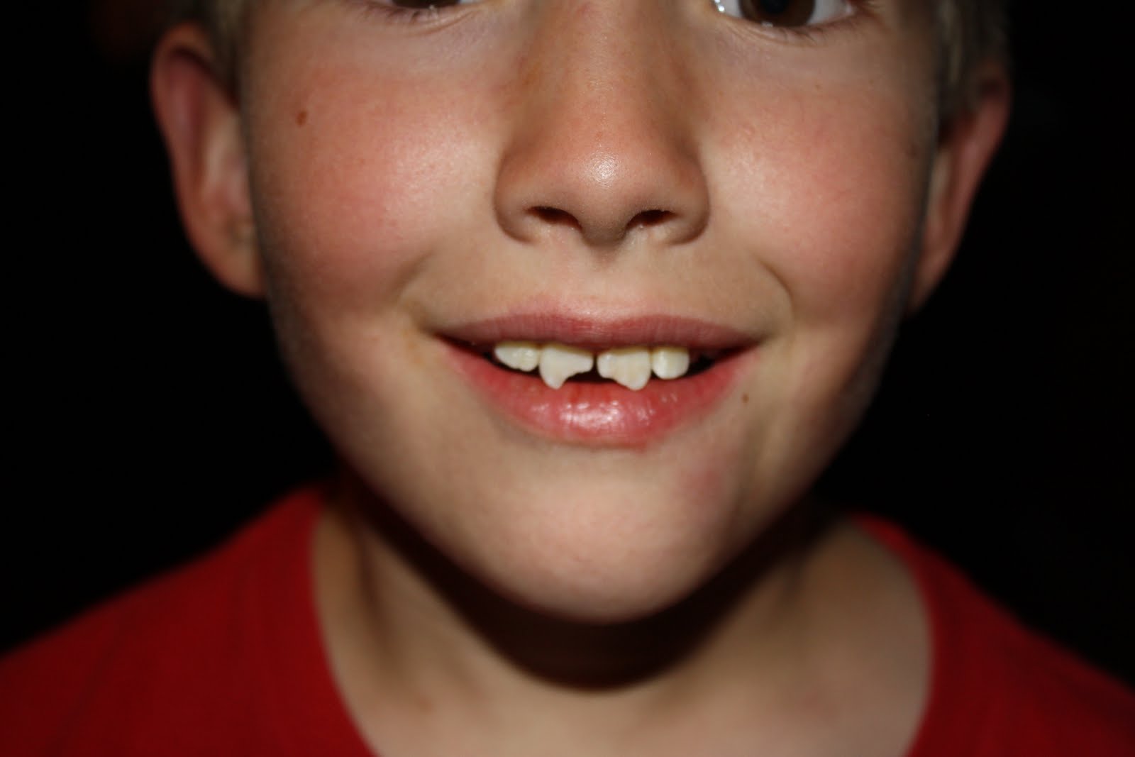 Them Dam Beavers Grant�s Chipped Tooth