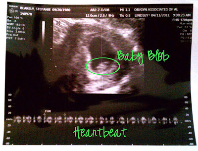 Healthy+heartbeat+at+8+weeks