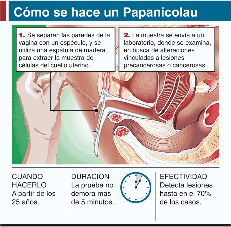 La gimnasia a las mialgias en la espalda