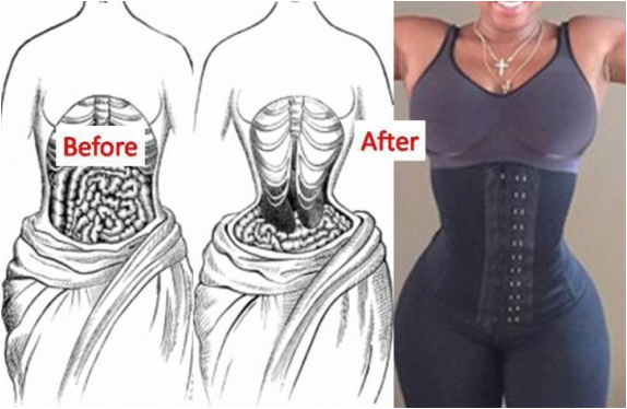 Girl Don T Use Corsets Or Waist Trainers Or Whatever You Wanna Call Them They Are Dangerous