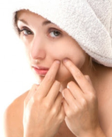 How to Remove Blackheads Quickly
