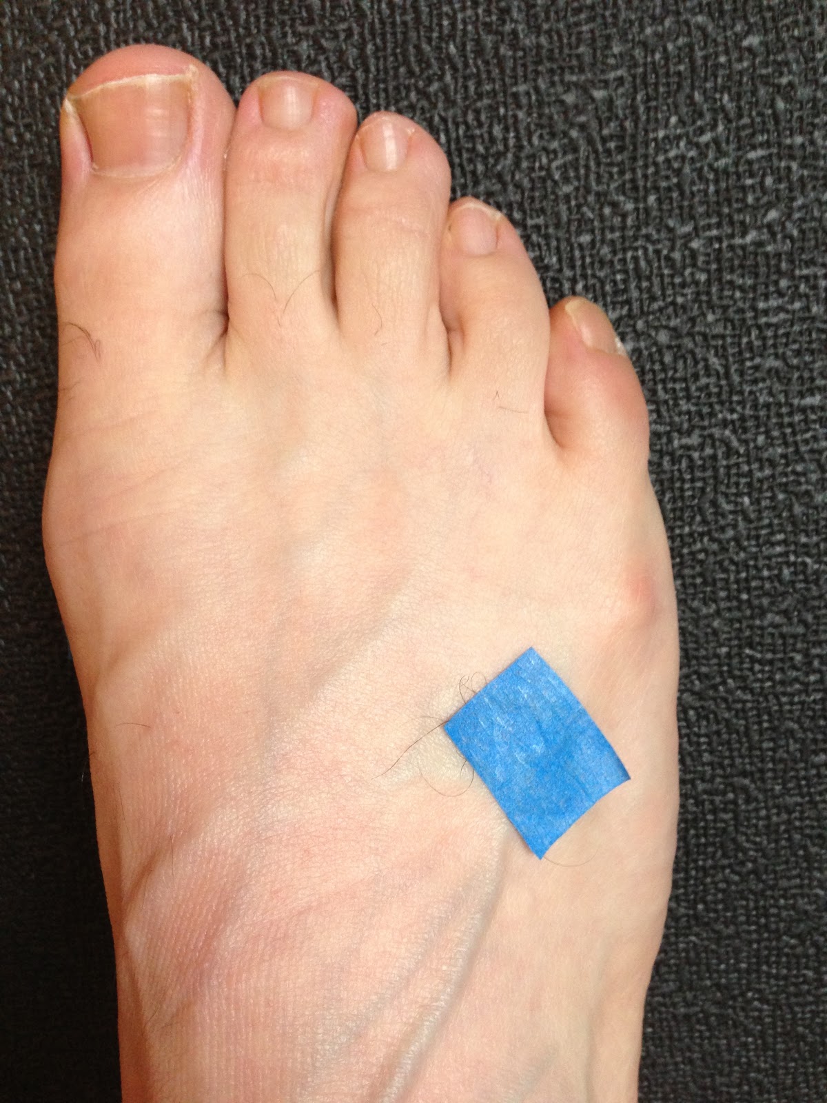 Back In Action Jetlag acupuncture points for traveling