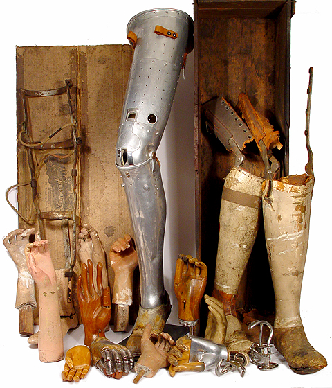 war and prosthetics Read about those in the civil war that used prosthetics after amputation find everything you need to know from national museum of civil war medicine. war and prosthetics Read about those in the civil war that used prosthetics after amputation find everything you need to know from national museum of civil war medicine.