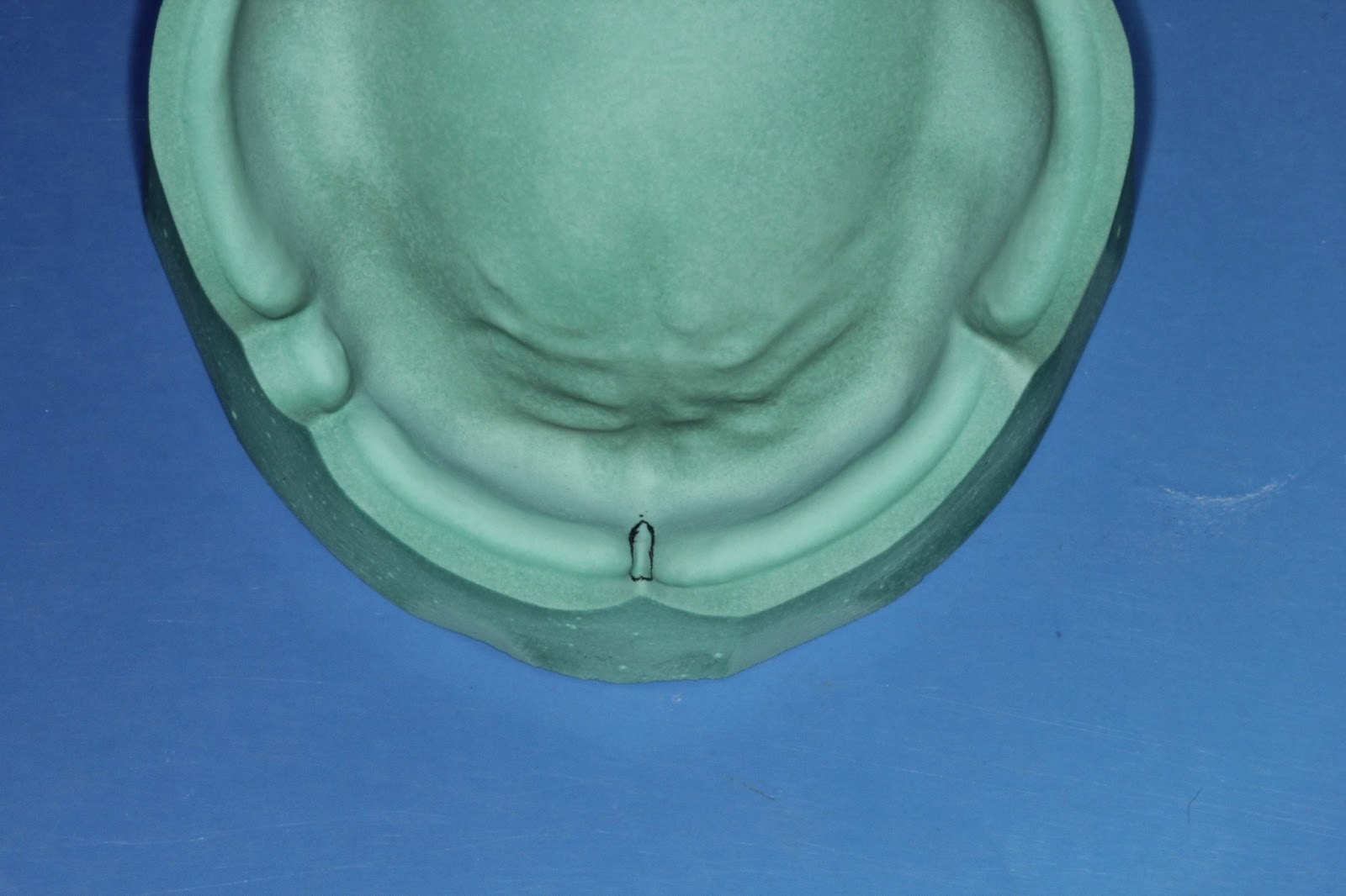 Step by step Guide for Understanding the Prosthodontics Anatomical