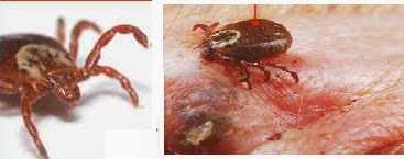 Ticks shape and on skin How Ticks live on skin?