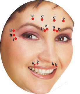 Botox areas