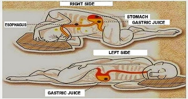 Related image