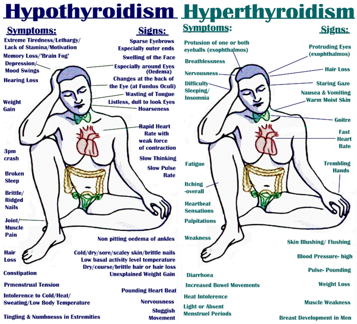 Type of Thyroid and Restrictions