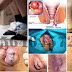 Beli Obat Wasir Tidak Perlu Ke Apotik atau Dokter thumbnail