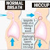 What Are Hiccups and How To Stop It