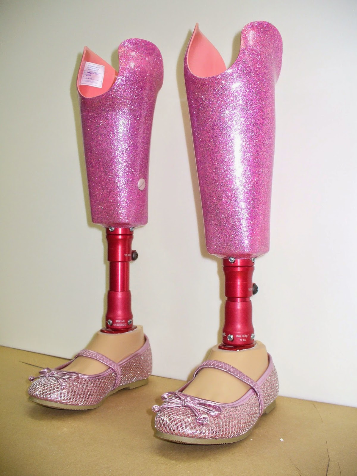 Prosthetic & Orthotic ขาเทียมในเด็ก