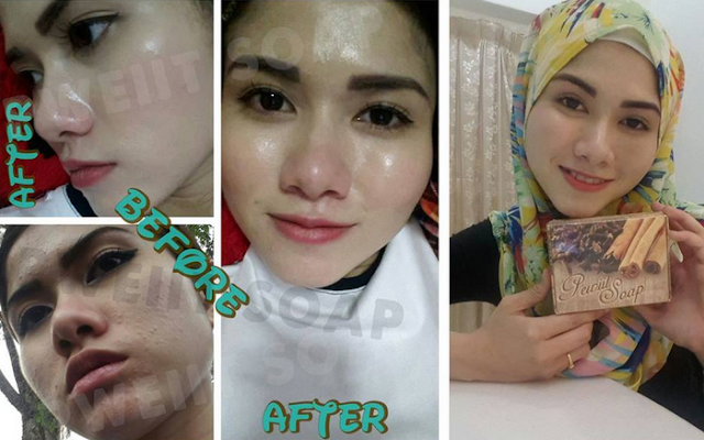 testimoni sabun pewitt