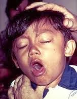 http://obatsinusitisakut.blogspot.com/2013/11/obat-tbc-untuk-anak.html