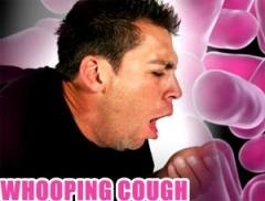 Whooping cough Whooping cough