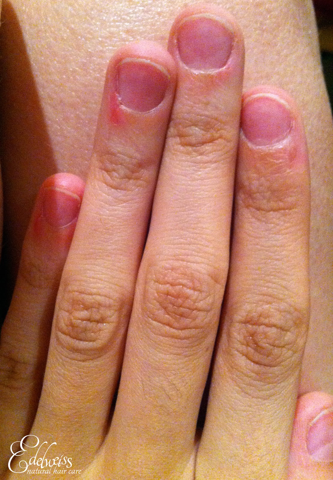 ongles rongés ricin soin au ricin pour ongles rongés