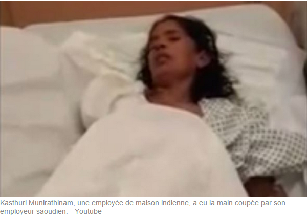 site rencontre amputée